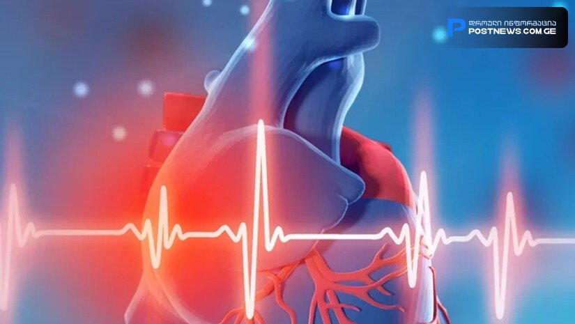 მოსალოდნელი ნიშნები ინფარქტამდე ექვსი თვით ადრე - უახლესი კვლევა