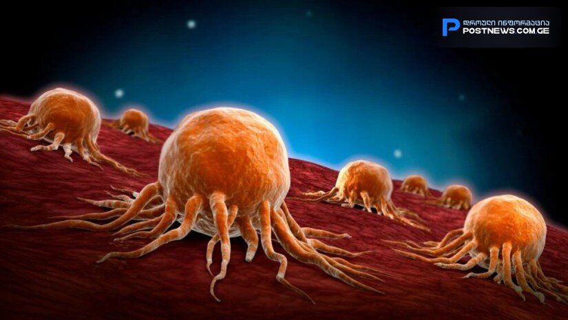 7 პროდუქტი, რომლებიც კიბოს უჯრედებს აქრობს