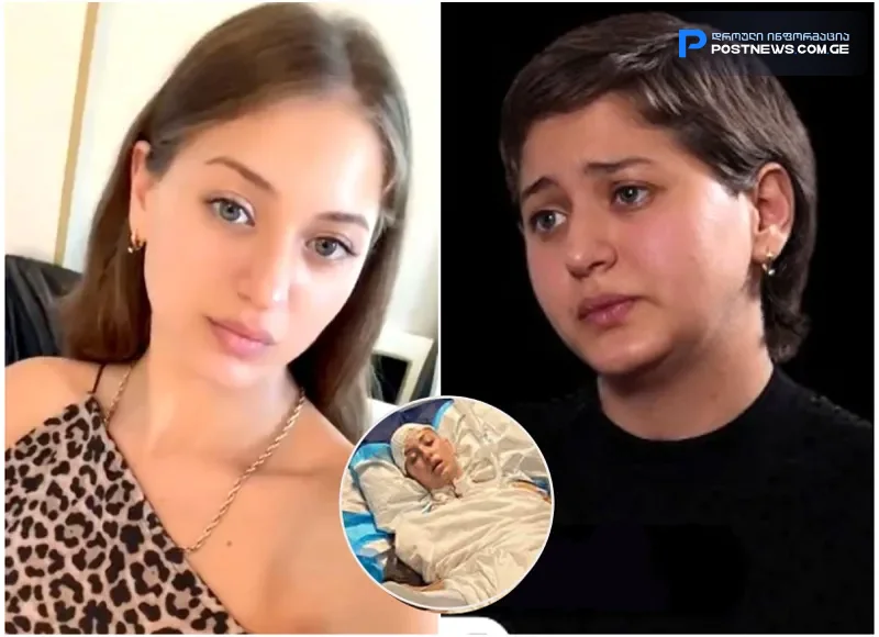 "ექიმებსაც კი უკვირთ, როგორ გადავრჩი და თქვენ ჩემი ასეთი გარეგნობა როგორ გაკვირვებთ? ნეტავ ჩემი ბაჩოც გადარჩენილიყო..." - რას წერს უმძიმეს ავარიას გადარჩენილი ლიკა კუჭუხიძე